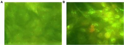 Protection of Cattle Elicited Using a Bivalent Lumpy Skin Disease Virus-Vectored Recombinant Rift Valley Fever Vaccine